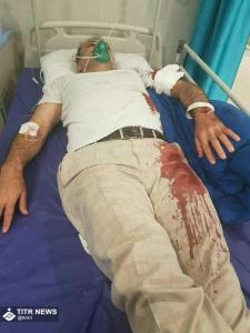 حمله به رئیس شورای اسلامی شهر بومهن با قمه