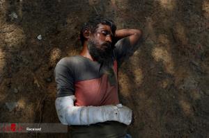 زخم‌های مسلمانان روهینگیا