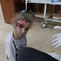  دختربچه فلسطینی مجروح از بمباران صهیونیست ها