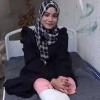 عکس/ لبخند امید بخش دختر فلسطینی که پاهایش قطع شده است!