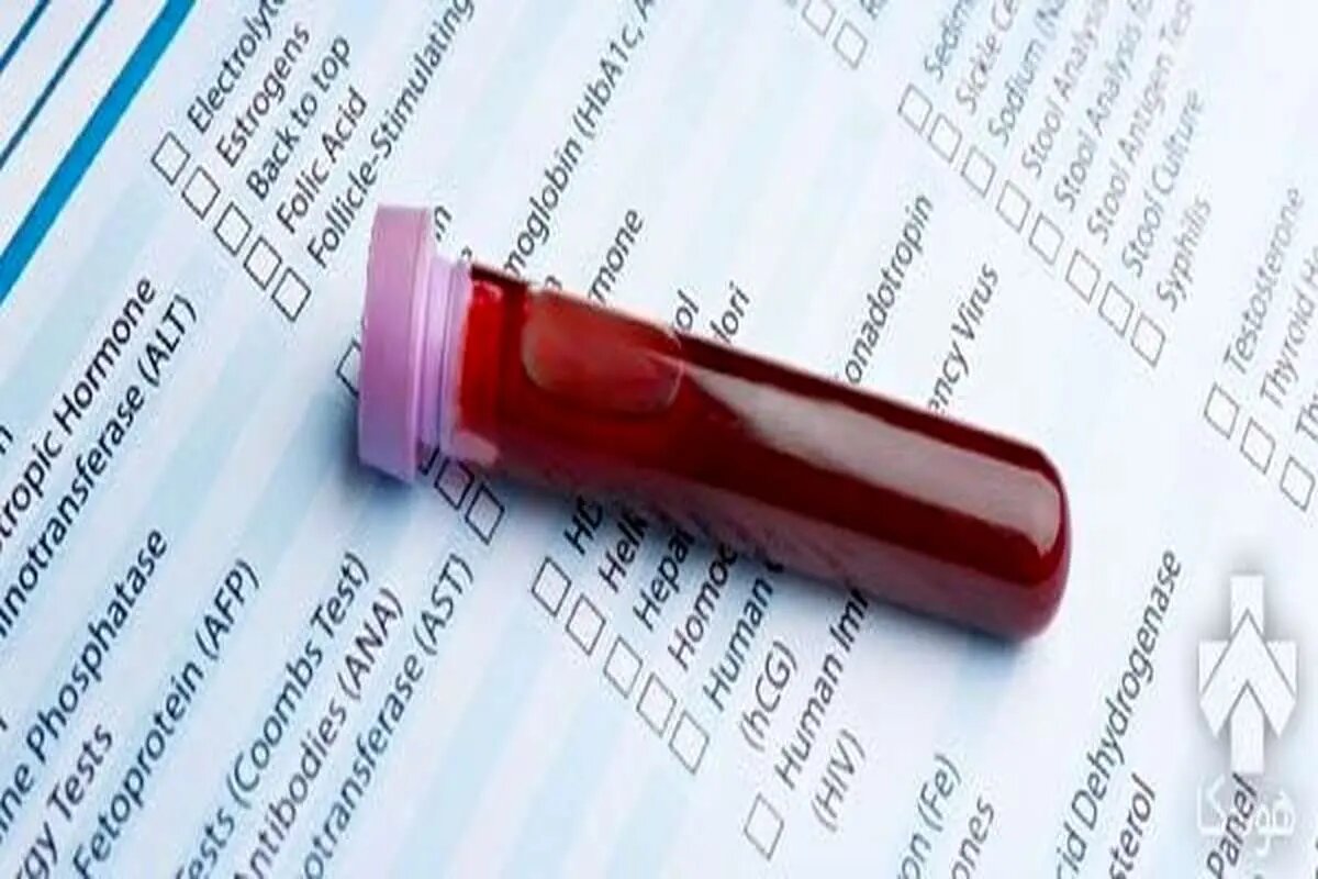 شناسایی 3 نوع سرطان با یک قطره خون