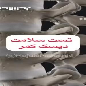 تست سلامت دیسک کمر