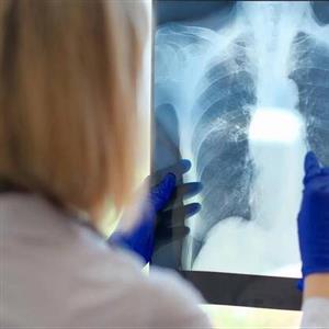 یک مشکل پنهان تنفسی ممکن است دلیل خستگی مزمن باشد