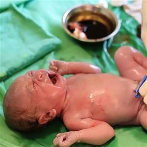 امید تازه برای درمان فلج مغزی کودکان و آرتروز