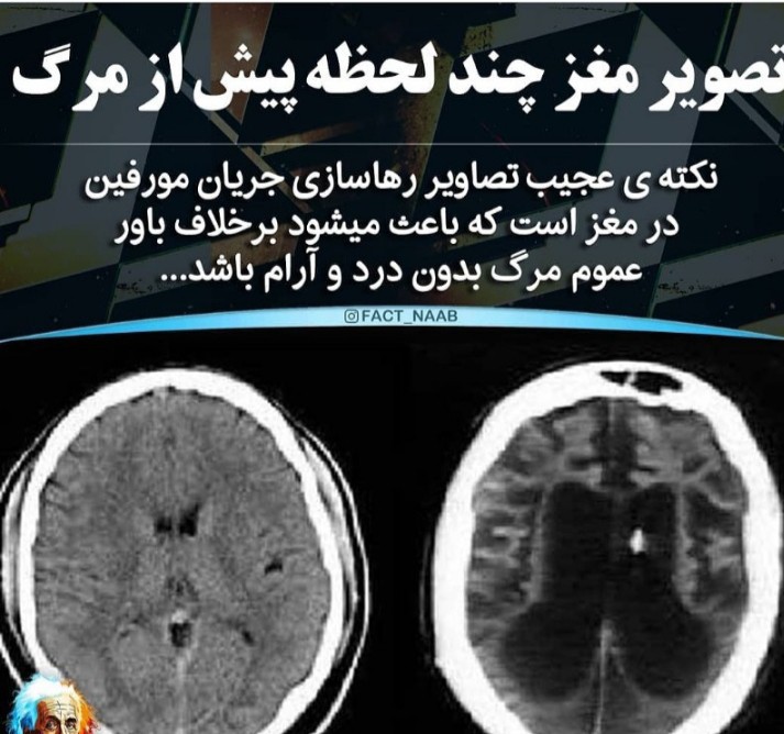 پيش از مرگ