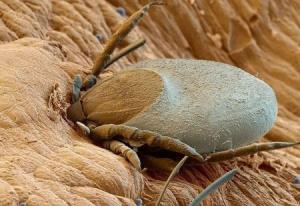 تصویر میکروسکوپی از حشره "کنه" هنگام ورود به پوست بدن