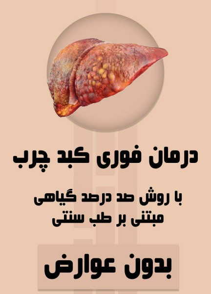 📌📌 علائم کبدچرب 👇🏻👇🏻

🔖_ زرد بودن روی زبان
🔖ــ زرد ب