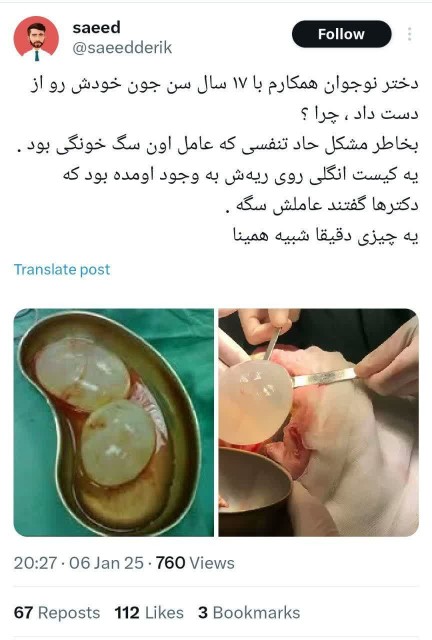 دکترها گفتن عاملش سگه