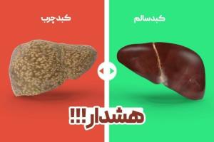 .
❌ تنهـا دلیل بوجـود اومـدن کبـدچـرب ..👇🏼
⚠️ سبک تغذیه و 