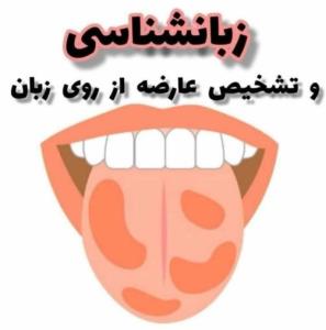 🔴🔴 زبان خبرچین ترین عضو بدن😳

➖دیدی خبرچین همیشه خبرا رو 