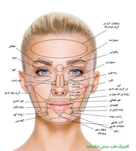 تشخیص بیماری از روی چهره