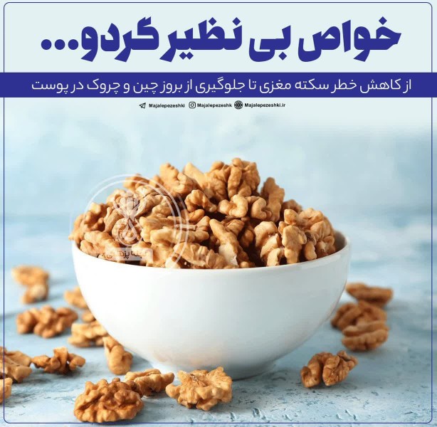 خواص بی نظیر گردو؛ از کاهش خطر سکته مغزی تا جلوگیری از بروز 