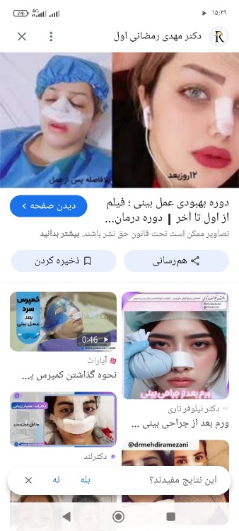 اینم که 🤐🤐🤐