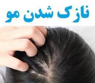 دلایل نازک شدن موها

