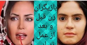 اگرعمل زیبایی نبود😐