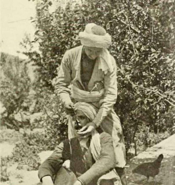 قدیما اینجور دندون می کشیدن , با یک وسیله شبیه انبردست که...