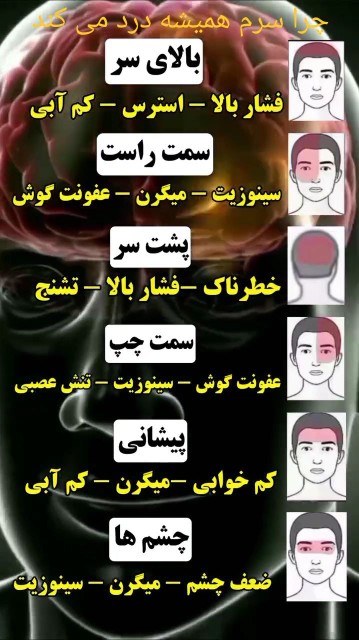 چرا سرم همیشه درد می کنه ؟🙄☝️