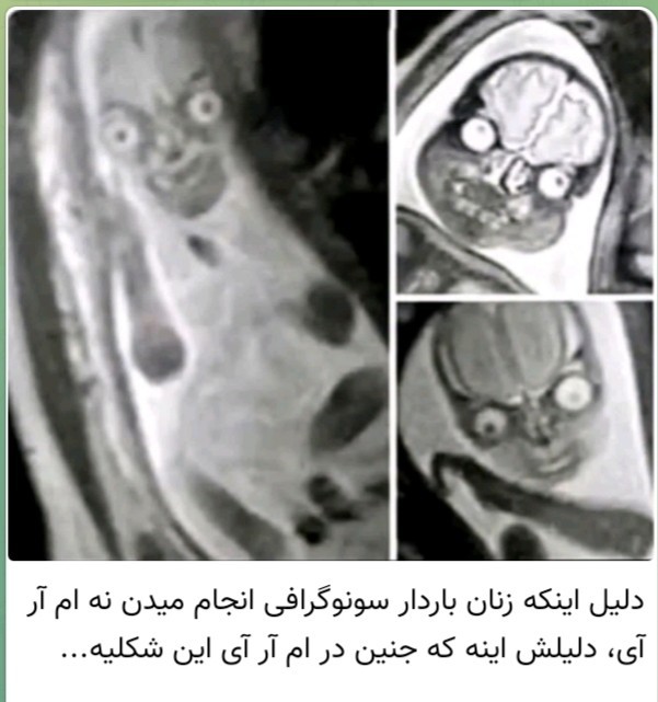 فرق سونوگرافی با ام آر آی در ....
