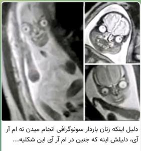 فرق سونوگرافی با ام آر آی در ....