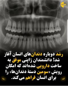 موفقیت ژاپنی ها 