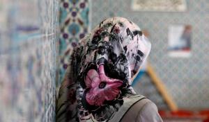شاهرگ گره 