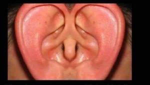 رابطه گوش و قلب👂↔️❤️‍🔥