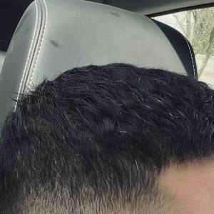 این حجم از سفیدی مو تو ۲۷ سالگی طبیعیه؟