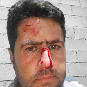 اشکال نداره بزرگ میشی یادت می‌ره😁😉