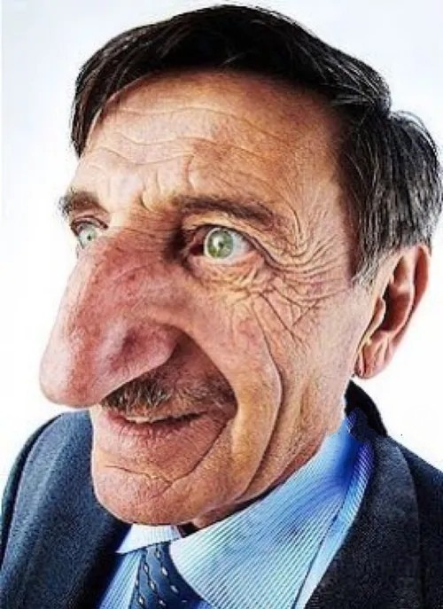 بزرگترین بینی جهان