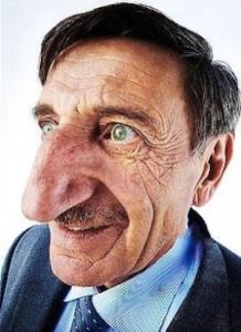 بزرگترین بینی جهان