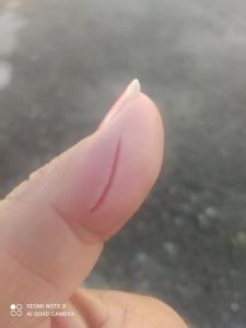 آخ از دردش🥺