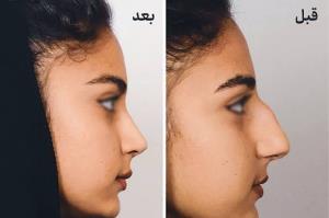 دست دکترش درد نکنه خدا خیرش بده 😂😂