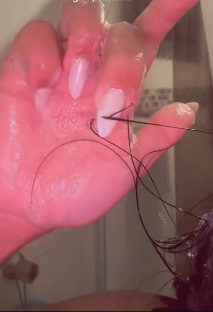 بد ترین درد با اختلاف

