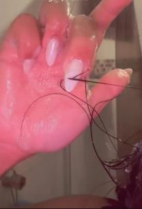 بد ترین درد با اختلاف

