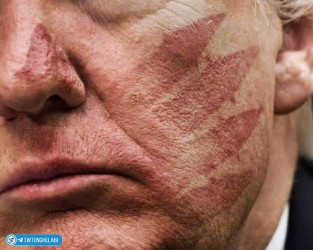 ترامپ.کتک خورد رفت