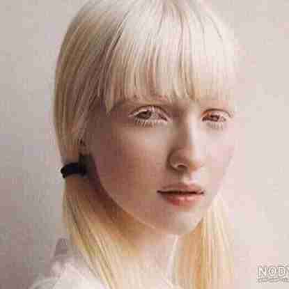 زین زین زین.......زایو زایو زایو.......دختر زال......دختر زال........سفید مو حتی مژه هاش........مو چتری تو کشور ژاپن و چین.....نژاداش متفاوتن......اروپایی آسیایی دارن.....زیبائی خدادی.....از آریایی کیوت تر .......کیوت تر ،کیوت تر ،کیوت تر....آره مثل ماه ‌........توهمونقصه نانوشته ای عشقم....منوباش.....واوو.....عاشق دختری زال شدم ........نادری 