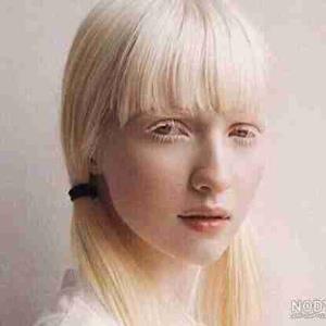 زین زین زین.......زایو زایو زایو.......دختر زال......دختر زال........سفید مو حتی مژه هاش........مو چتری تو کشور ژاپن و چین.....نژاداش متفاوتن......اروپایی آسیایی دارن.....زیبائی خدادی.....از آریایی کیوت تر .......کیوت تر ،کیوت تر ،کیوت تر....آره مثل ماه ‌........توهمونقصه نانوشته ای عشقم....منوباش.....واوو.....عاشق دختری زال شدم ........نادری 