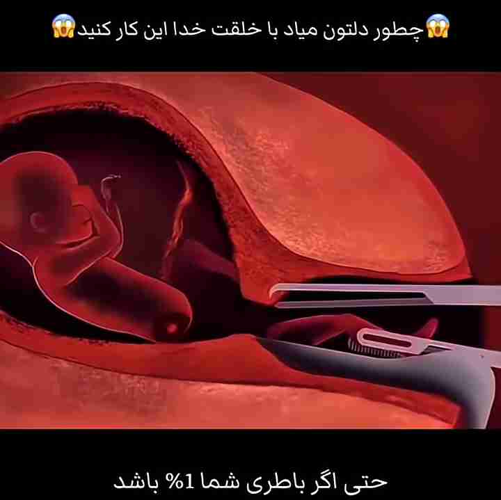 هموطن خیلی ها در حسرت فرزند بال و پر میزنند،شما را به هرچی میپرستید با تفکر آگاهانه تصمیم بگیریم.و مرتکب قتل نفس نشویم."پاسخگوی سوالات حقوقی شما فقط به نیت رضای خداوند و اهل بیت.