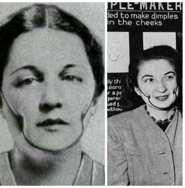 ♦️دستگاه چال گونه در سال 1945 در امریکا؛
