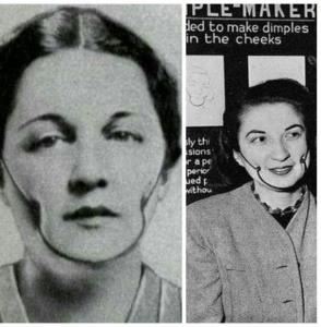 ♦️دستگاه چال گونه در سال 1945 در امریکا؛
