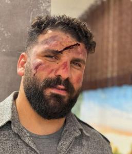 عاقبت برای فالوور:

وضعتان چونه 😐😂😂🤣🤣🤣