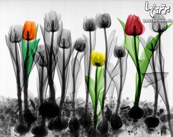 عکس/ هنرنمایی جالب با عکس‌ های رادیولوژی!