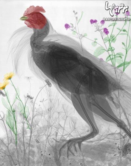 عکس/ هنرنمایی جالب با عکس‌ های رادیولوژی!