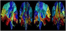 نمایش افزایش و کاهش حجم مغز در طول عمر انسان 
