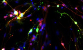 تولید «نورون‌های سروتونین» انسانی در ظرف آزمایشگاهی