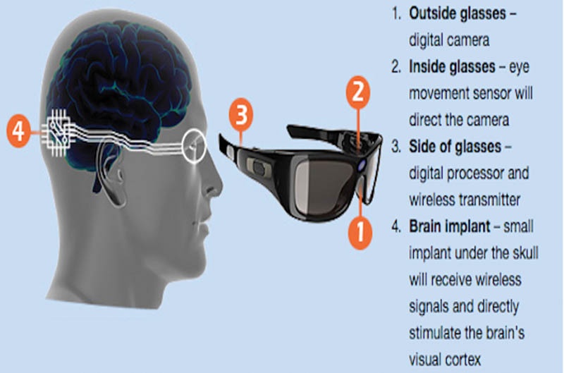 ترمیم بینایی مصنوعی با دوربین چشمی و تراشه مغزی