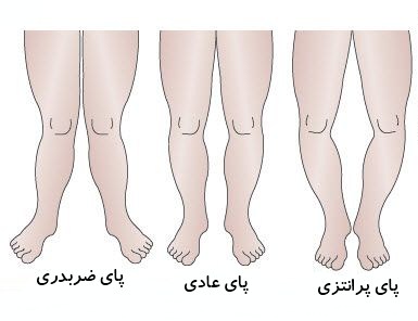 دکتر سلام/ بهترین راه های پا پرانتزی