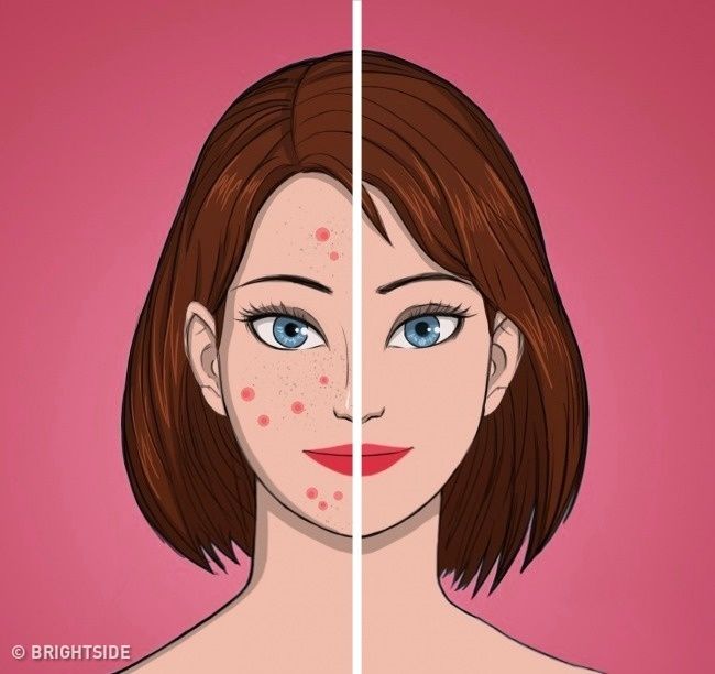 چرا باید آرایش صورت را پیش از خواب پاک کنید؟