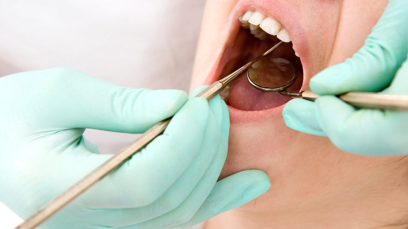 دهان و دندان/ اقدامات ضروری بعد از «کشیدن دندان»