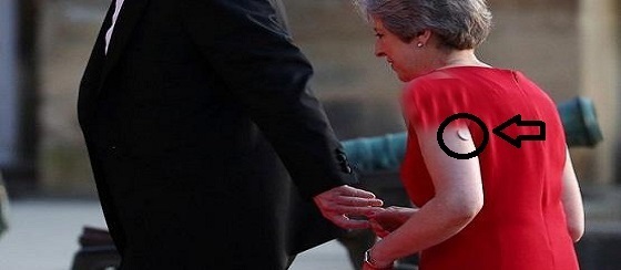 راز شی مرموز روی دست خانم نخست وزیر